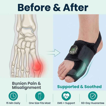 EMS Bunion Corrector