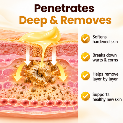 BeeClear Wart & Corn Renewal Cream